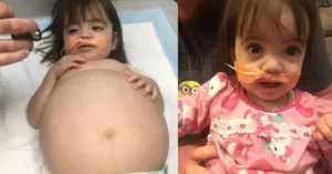 Dad performs a life-saving transplant on his daughter to save her