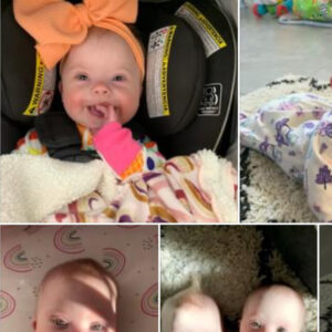 Florida woman gives birth to rare set of identical twins with Down syndrome – Look How Cute They Are..