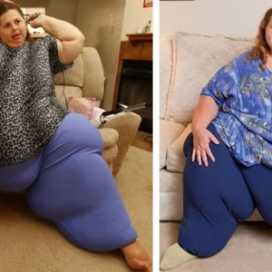 What Strength! What Does the 57-year-old woman who lost 518 pounds Look Like Now?