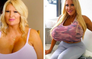 Model with the most non-standard forms: how this woman looked before plastic surgery