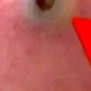 Symptoms That May Reveal Health Big Problems Symptoms That May Reveal Health Big Problems