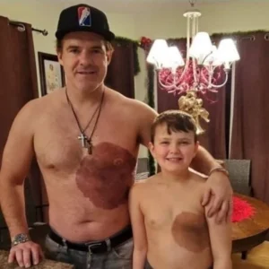 Dad Gets Matching Birthmark Tattoo to Show His Son That Being ‘Different’ Can Be Cool Dad Gets Matching Birthmark Tattoo to Show His Son That Being ‘Different’ Can Be Cool