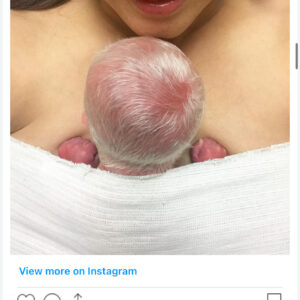 Baby mocked for having white hair – years later, he looks perfectly happy and healthy.