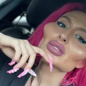 Woman with ‘world’s biggest cheeks’ is unrecognizable in pic taken six years ago
