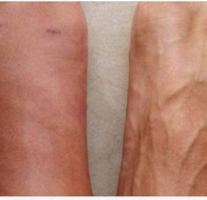 One Month Before A Heart Attack, Your Body Will Warn You Of These 7 Signs One Month Before A Heart Attack, Your Body Will Warn You Of These 7 Signs
