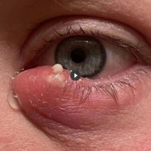 Is There a Recently Discovered Lethal Insect Species that Creates Multiple Small Holes in Palms?
