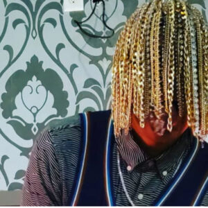 Rapper had surgery to get gold chains implanted into his skull
