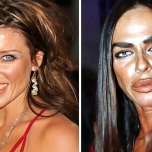 🤯She was once one of the most beautiful women in Italy, but she disfigured her face with plastic surgeries.😱 🤯She was once one of the most beautiful women in Italy, but she disfigured her face with plastic surgeries.😱
