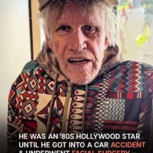 He Was A Hollywood Star In The ’80s, But Then Survived A Terrible Road Accident & Underwent Facial Surgery – His Pics At 80