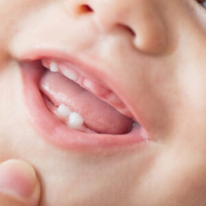 Keep baby’s teeth: They can save your child’s life in the future