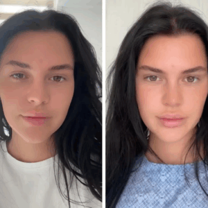 Young Woman Documents Her Fox Eye Surgery—and the Internet Can’t Stop Talking About the Results Young Woman Documents Her Fox Eye Surgery—and the Internet Can’t Stop Talking About the Results