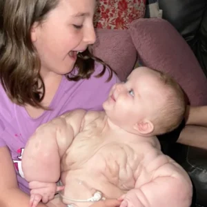 The Remarkable Story of “Baby Hulk,” the Newborn Girl Who Survived Against All Odds and Doctors’ Predictions The Remarkable Story of “Baby Hulk,” the Newborn Girl Who Survived Against All Odds and Doctors’ Predictions