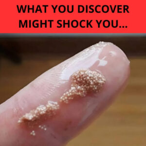 White Residue in Eggs: Should You Panic or Stay Calm? What You Discover Might Shock You… White Residue in Eggs: Should You Panic or Stay Calm? What You Discover Might Shock You…
