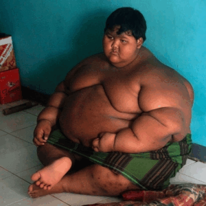From Burdened to Brave: Arya Permana’s Shocking 238-Pound Transformation That Inspired the World From Burdened to Brave: Arya Permana’s Shocking 238-Pound Transformation That Inspired the World
