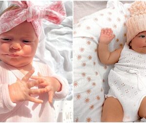 What looked like an adorable smile on their baby turned into a jaw-dropping diagnosis no one expected.