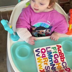 This is the girl’s current appearance following treatment. She was born with unusually huge hands and appeared to be a bodybuilder.