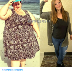 Lexi Reed’s Inspiring Transformation: From Battling a Rare Disease at 485 Pounds to Rocking a Swimsuit with Confidence