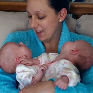 Conjoined Twins Belle and Abby, From Birth to Separation